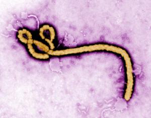 ebola, bacteria vs virus, virus