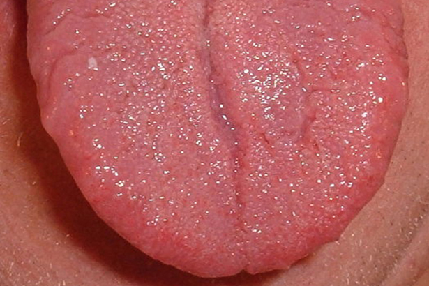 Are You A Supertaster Precision Laboratories Test Strips