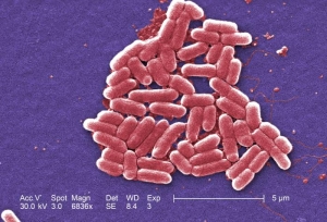 kitchen sponge germs, e. coli